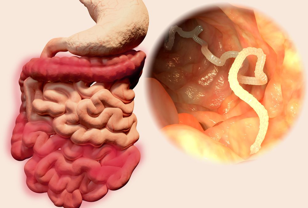 Constipation chronique et infection parasitaire